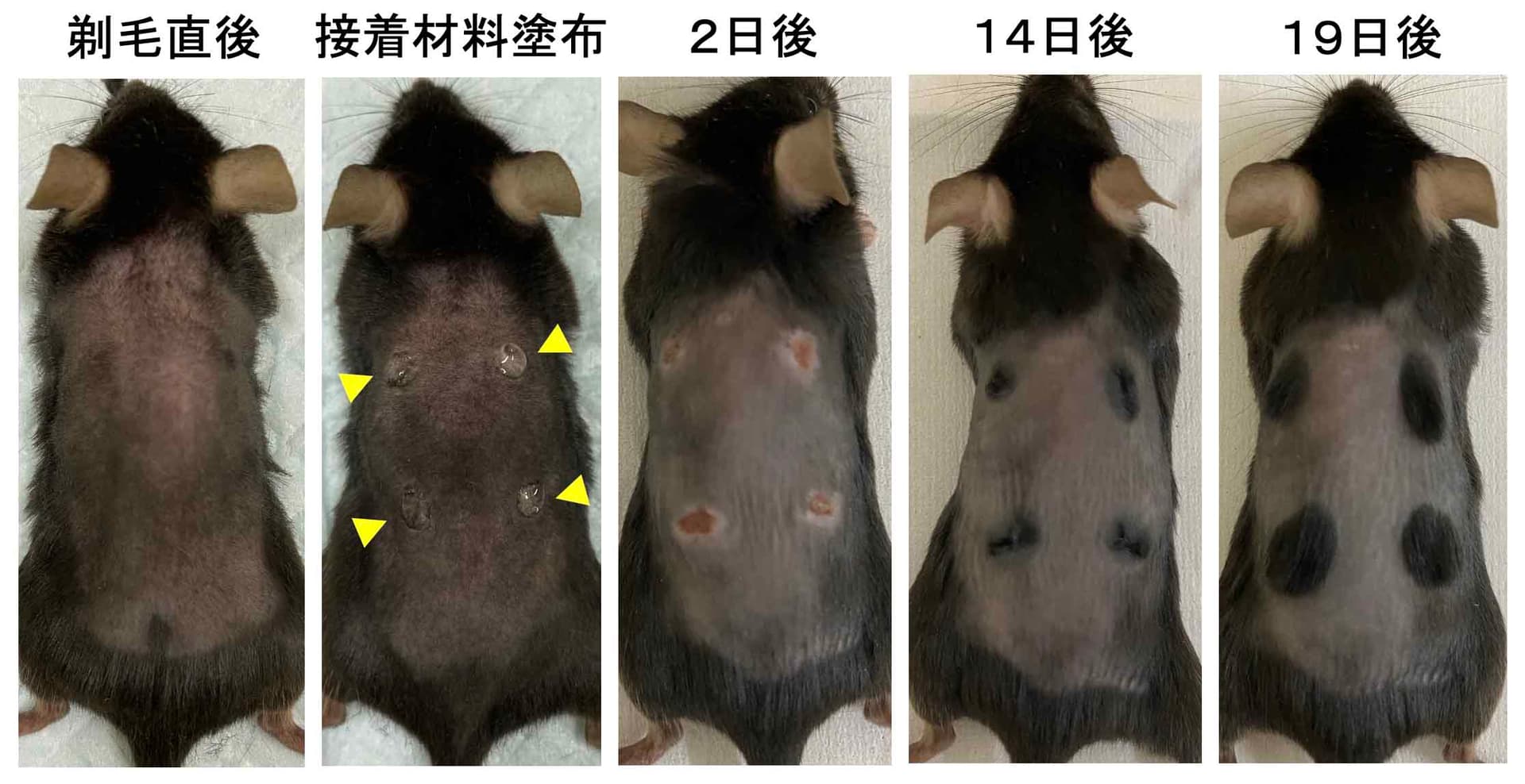 단 한 방울 바르는 것만으로 완벽한 발모… 규슈치과대학교, 접착성 재료의 발모 효과 확인